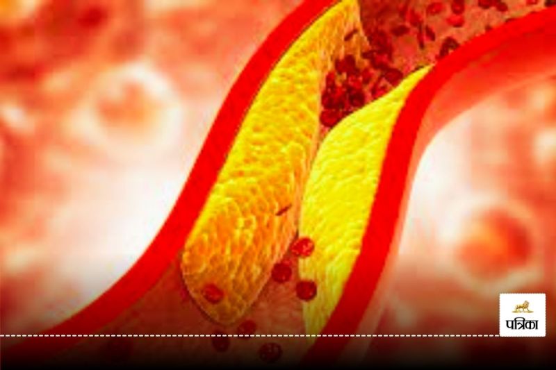 Symptoms of increased cholesterol