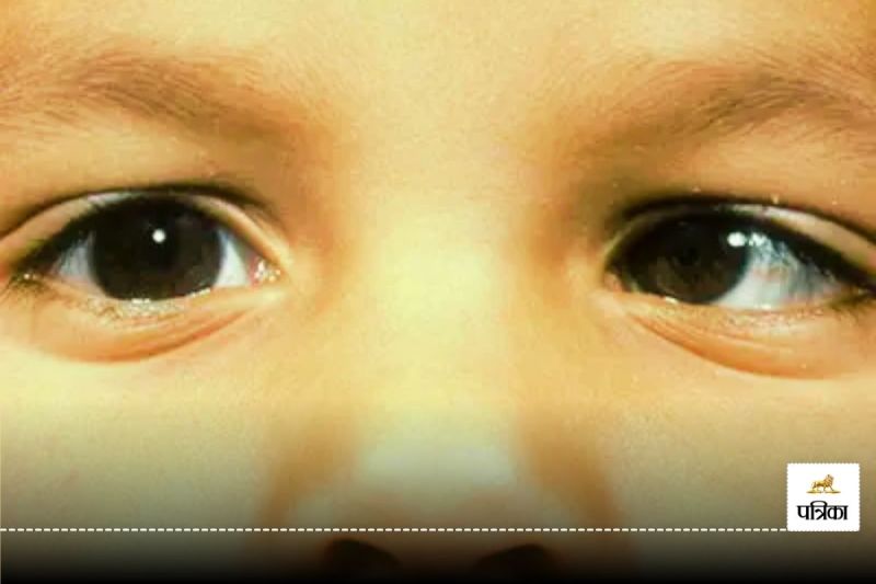 Signs of Vision Problems: Keep an Eye on Your Child’s Health