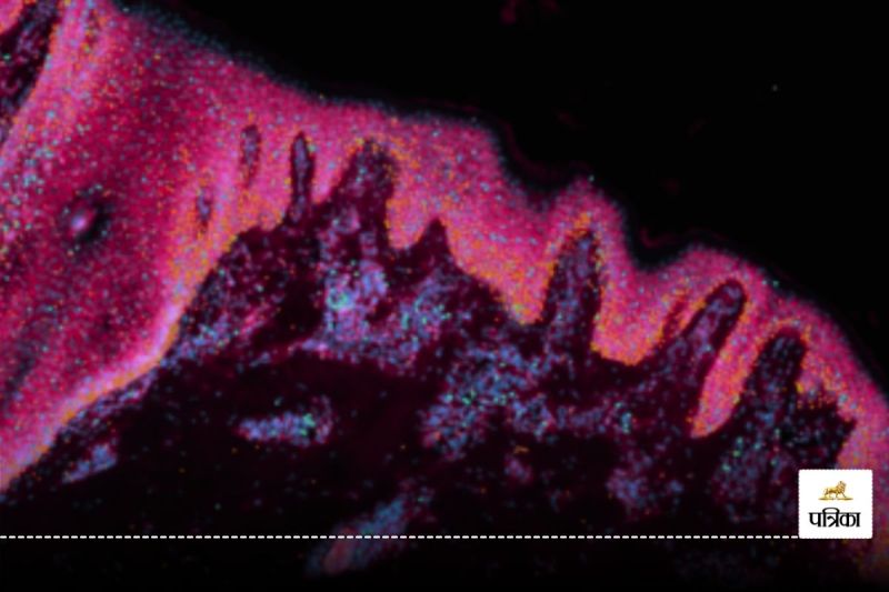 First Single-Cell Map of Human Skin Created, Revolutionizing Skin Disease Treatments