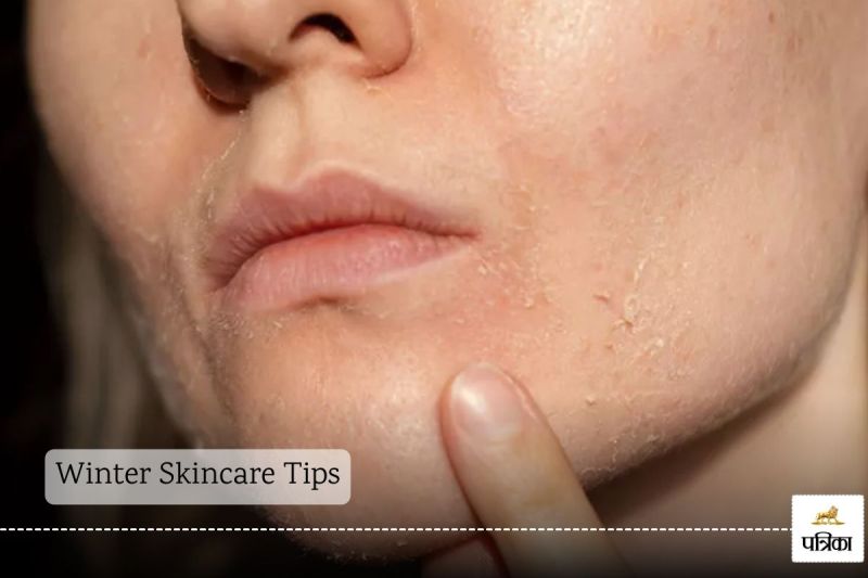 Winter Skincare Tips: Before winter arrives, white lines have started appearing on the skin, then immediately adopt these home remedies.