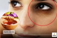Dark circles will reduce within a week if these 3 things are mixed with honey and applied