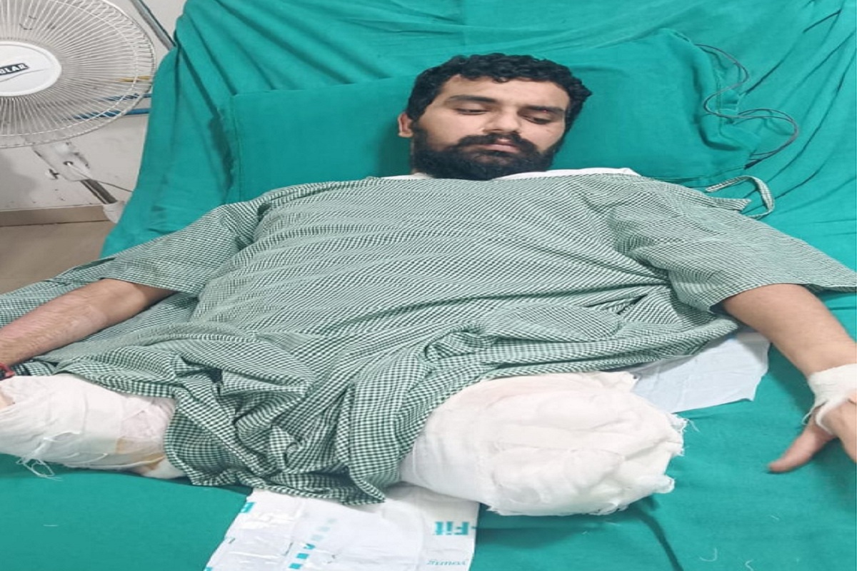 ससुराल आ रहे युवक के हादसे में कट गए थे दोनों पांव, CM की विशेष मदद से बच गई जान