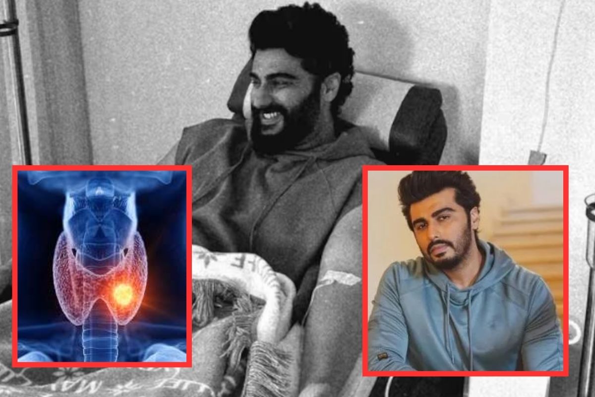 Arjun Kapoor Hashimoto's Disease