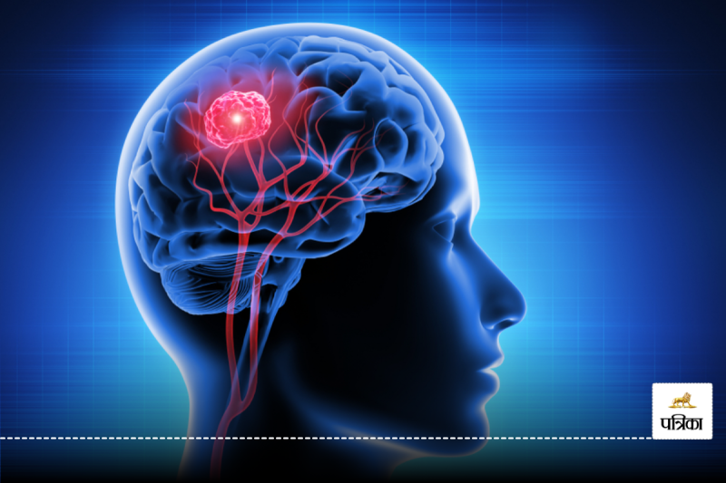 signs of brain tumor : These can be signs of tumor in the brain, you should also know
