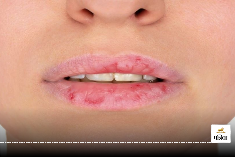 Vitamin B6 overcome deficiency