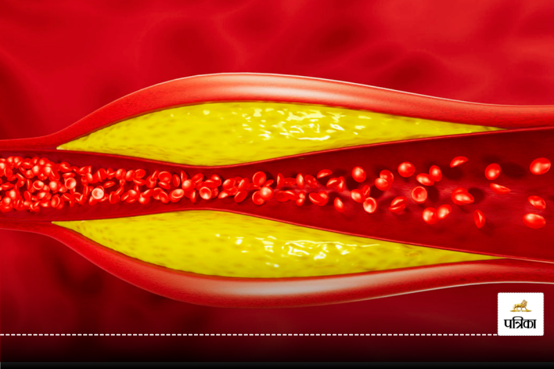 Lower Bad Cholesterol Naturally