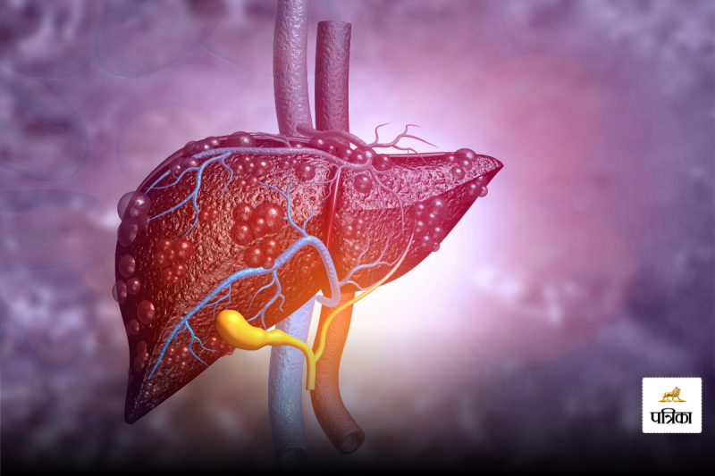 Urine Signs of liver damage