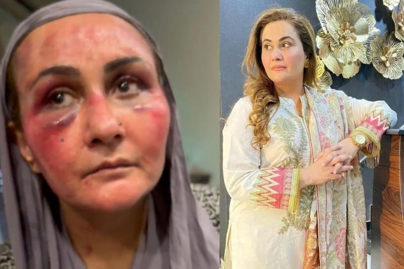 Pakistani actress reveals brutal torture Hit by gun and dragged by hair