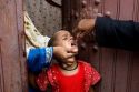 Pakistan: 46th polio case in Balochistan raises health concerns