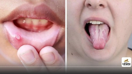 Stage 0 cancer symptoms