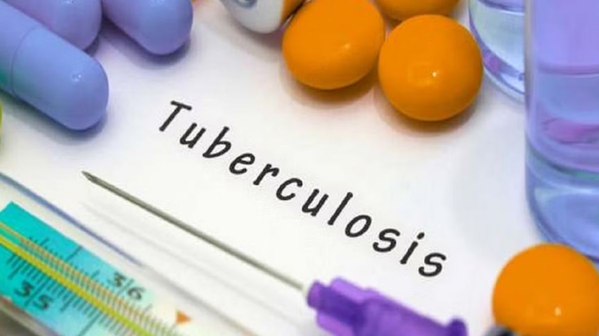 TB Clinic: पहली डोज के लिए ‘वेटिंग’, अफसर कह रहे… औषधि मिलने में हो रही थी देरी,