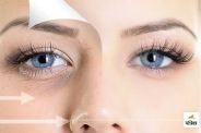 How to get rid of dark circles in home