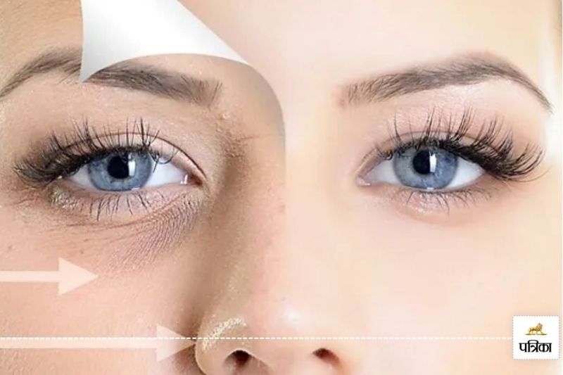 How to get rid of dark circles in home