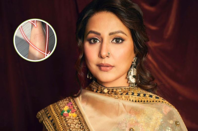 Hina Khan Got injured in Maldives Shares Picture on instagram