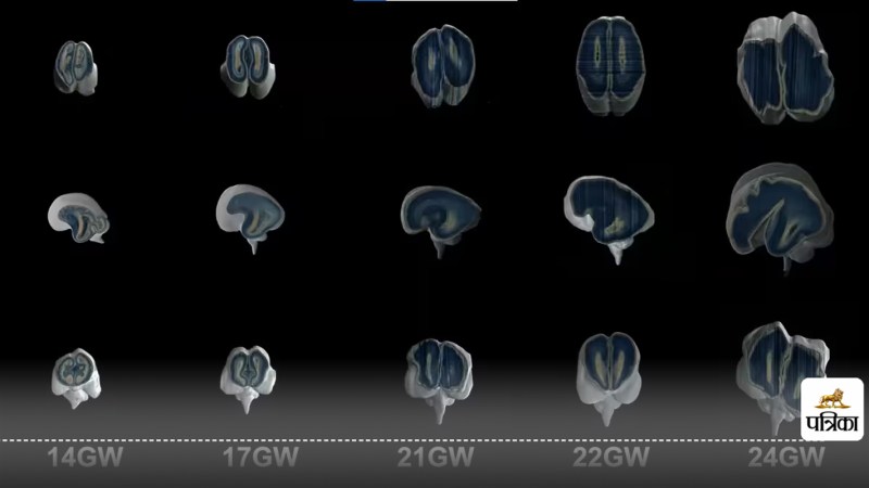 IIT Madras Unveils the Mysteries of the Baby Brain
