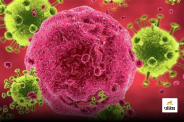 symptoms of HIV