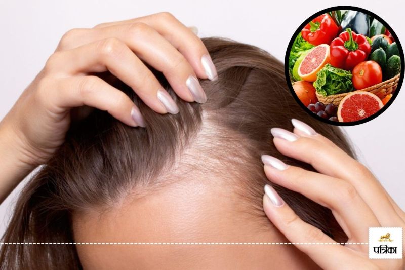 Foods to prevent hair loss