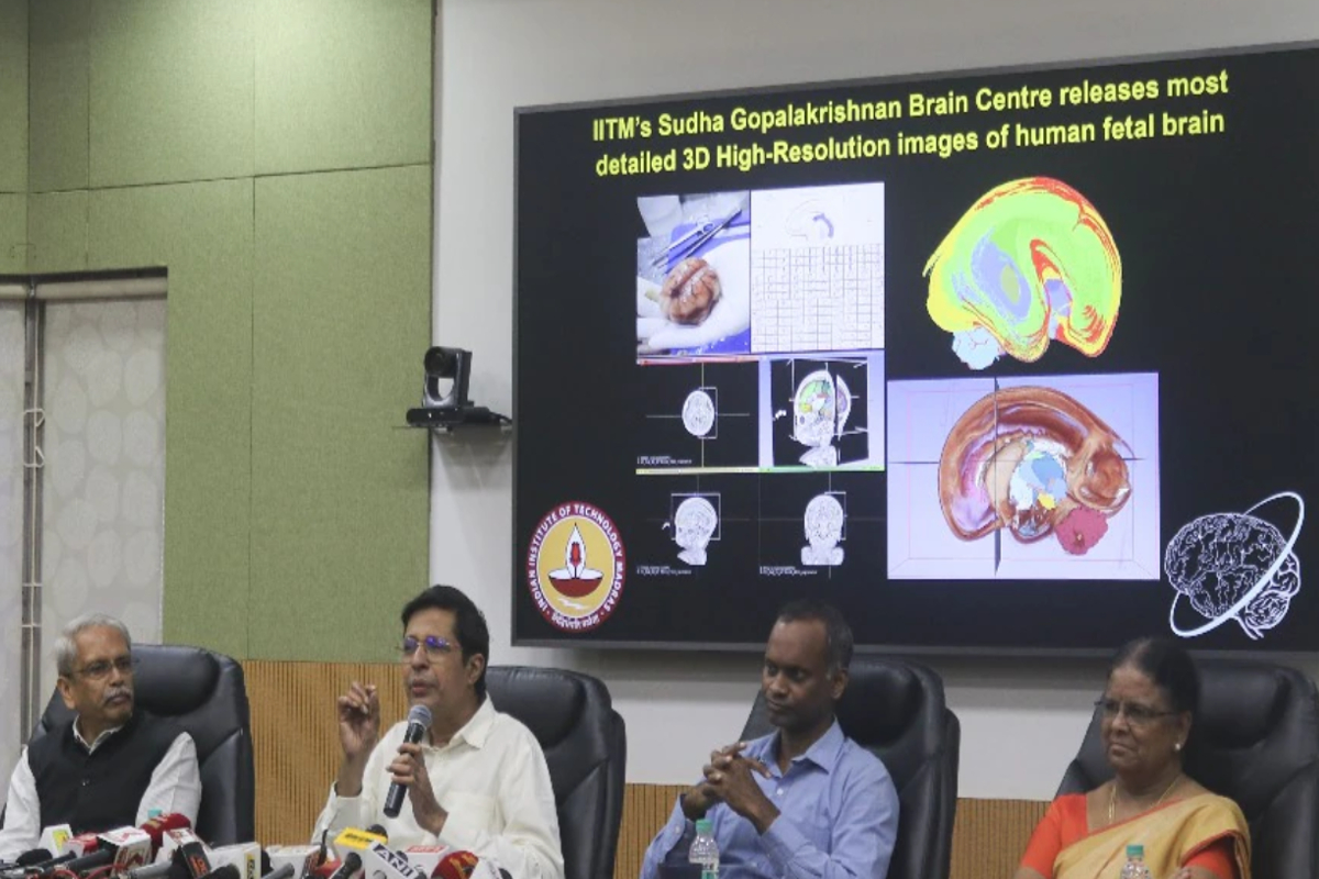 दुनिया में पहली बार…IIT मद्रास ने जारी की इंसानी शरीर के इस हिस्से की 3D
तस्वीरें