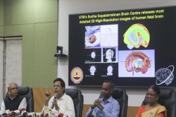 दुनिया में पहली बार…IIT मद्रास ने जारी की इंसानी शरीर के इस हिस्से की 3D
तस्वीरें - image