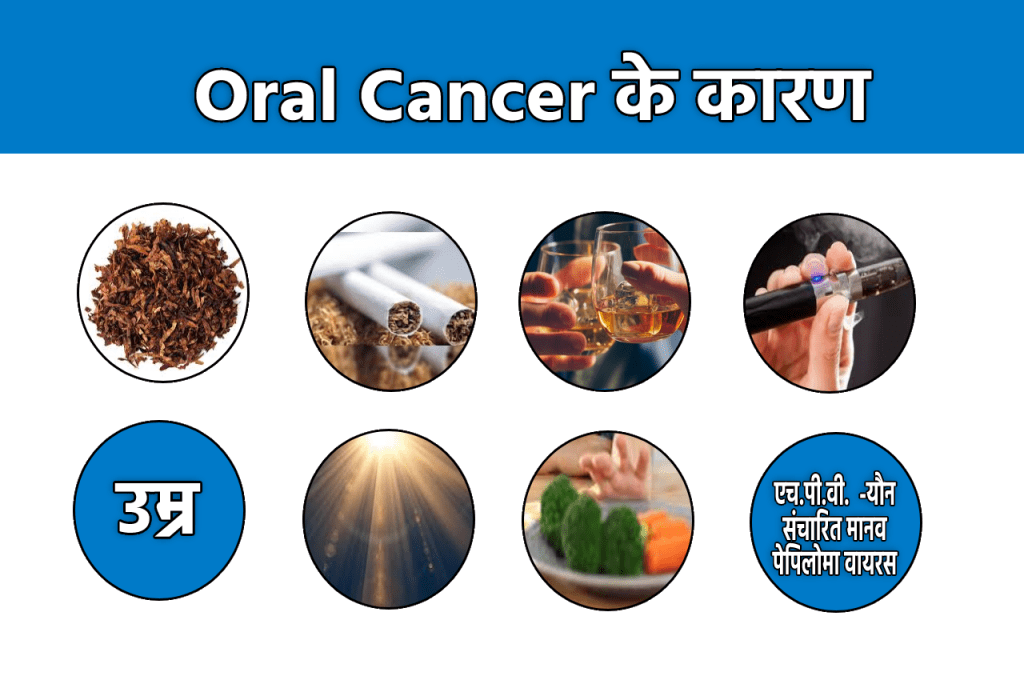 Oral Cancer