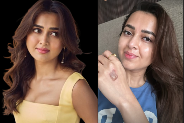 Tejasswi-Prakash-Injured-News