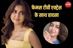 Tejasswi Prakash: फेमस टीवी एक्ट्रेस का जल गया हाथ, फोटो देख डरे फैंस - image