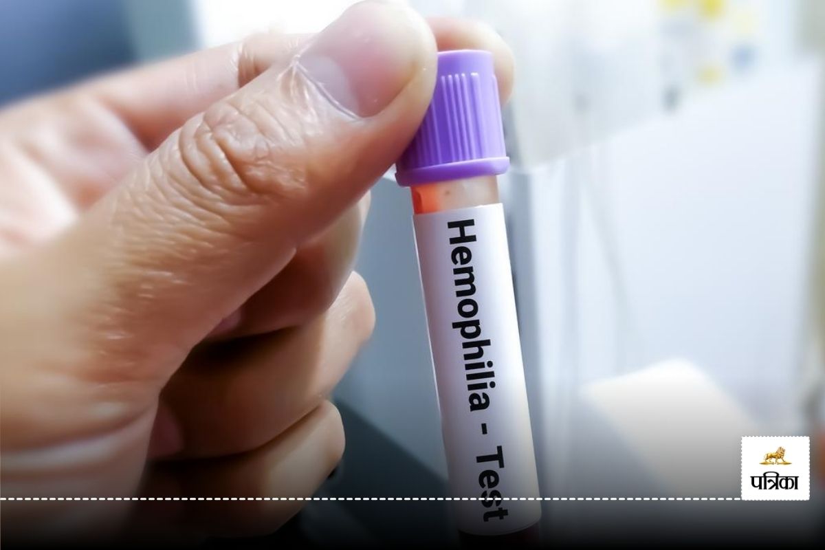 Haemophilia A