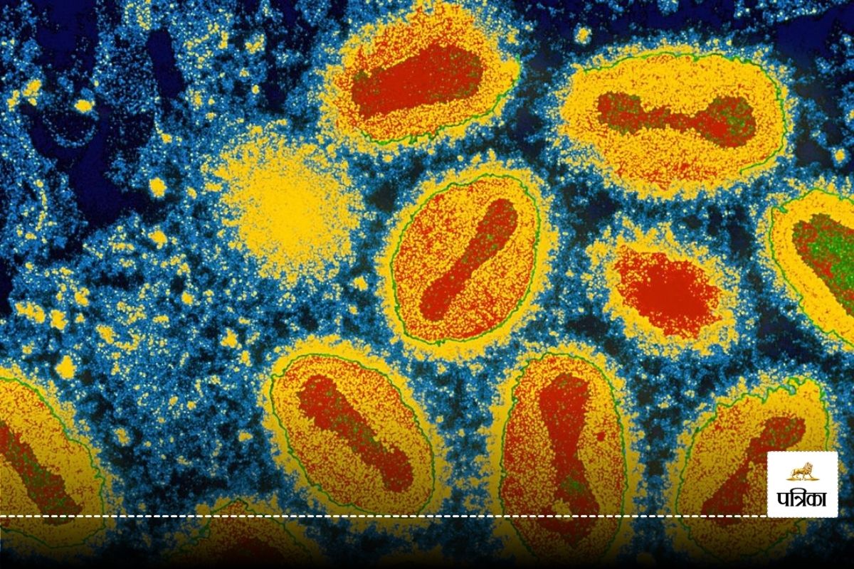 virus more dangerous than COVID 19 disappeared from Australia lab