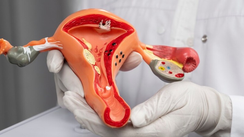 Cervical Cancer Symptoms Do not ignore these early warning signs