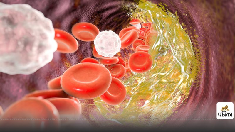 Cholesterol kam karne ke upay