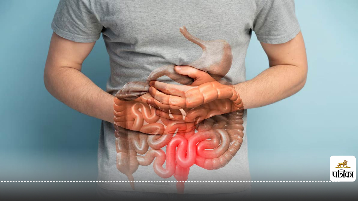 युवाओं में क्यों बढ़ रहा है Colorectal cancer, इस आकार के शरीर में होता अधिक
खतरा