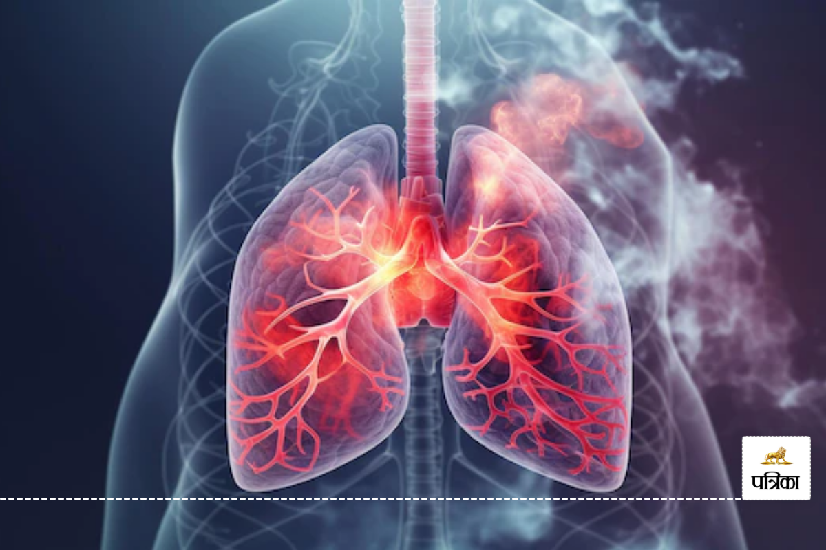 World Lung Day: स्मोकिंग फेफड़ो का सबसे बड़ा दुश्मन, TB की शक्ल में बाहर आ रही बीमारी, इस तरह रखें ध्यान...(photo-patrika)