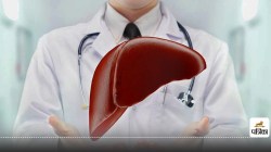 Fatty Liver : फैटी लिवर से छुटकारा, अपनाएं ये 3 आसान घरेलू नुस्खे - image