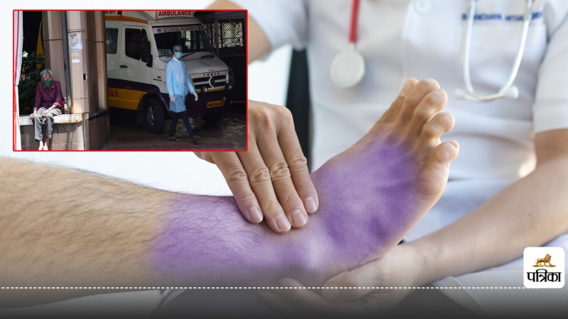 Guillain-Barre syndrome What is this dangerous disease the government announced free treatment