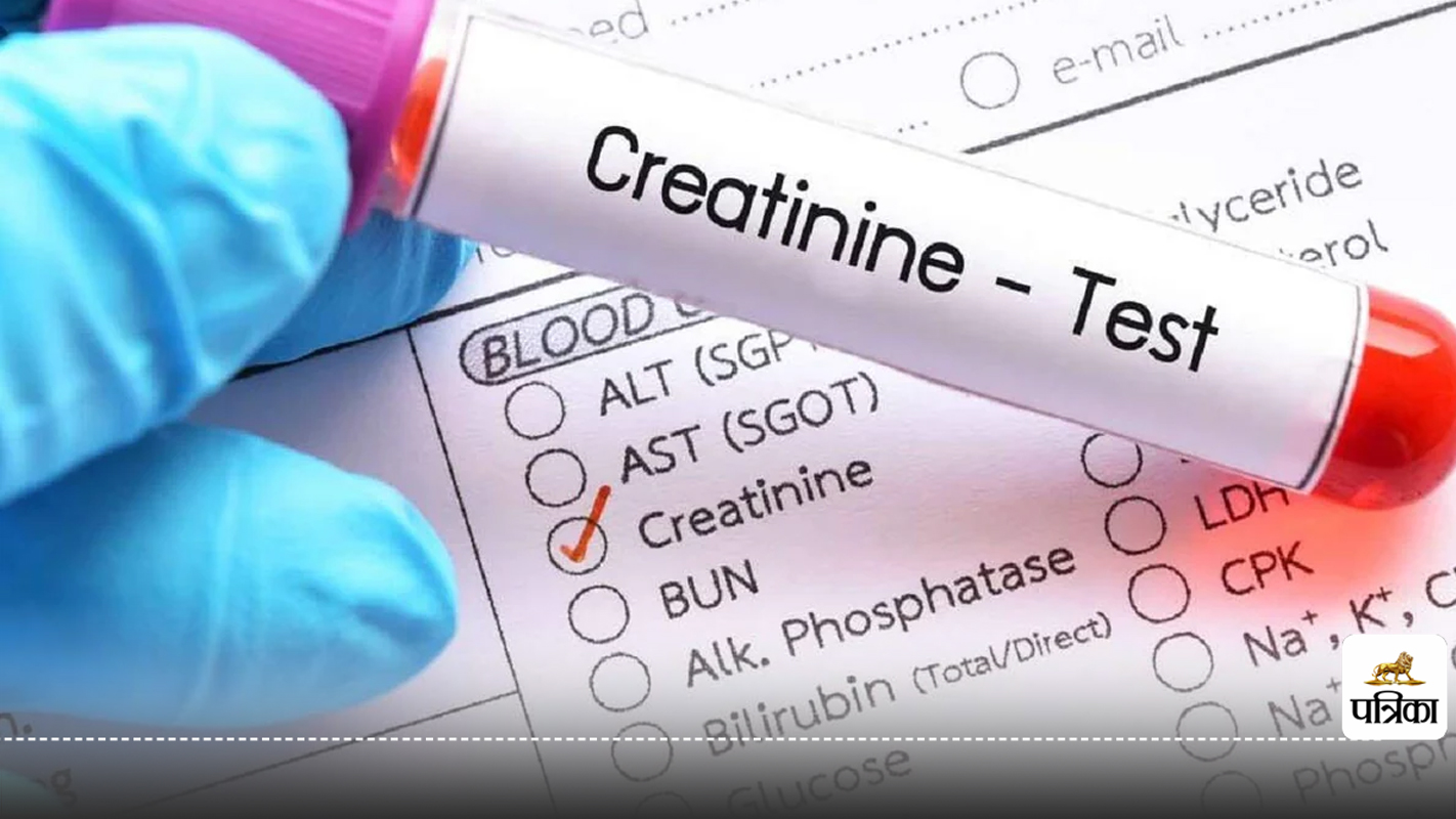 High Creatinine Levels : किडनी डैमेज का संकेत है हाई क्रिएटिनिन, नॉर्मल लेवल
कितना होना चाहिए?