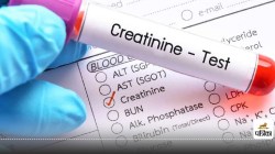 High Creatinine Levels : किडनी डैमेज का संकेत है हाई क्रिएटिनिन, नॉर्मल लेवल
कितना होना चाहिए? - image