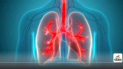 Lung Transplants : महिलाओं की 5 साल तक जीवित रहने की संभावना ज्यादा - image