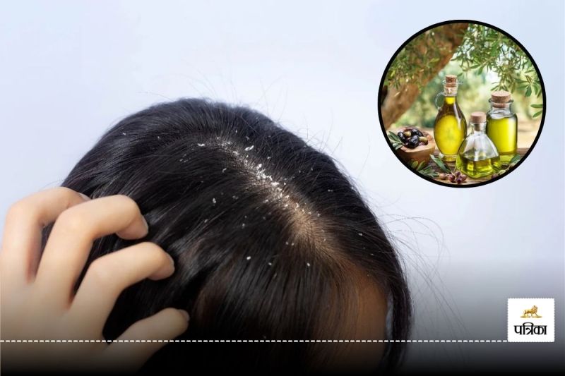 Olive Oil For Dandruff