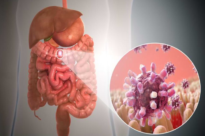 Rare medical case in Hamidia Hospital
