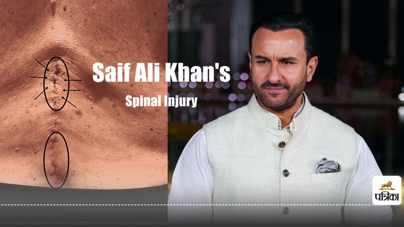 Saif Ali Khan Spinal Fluid Leakage