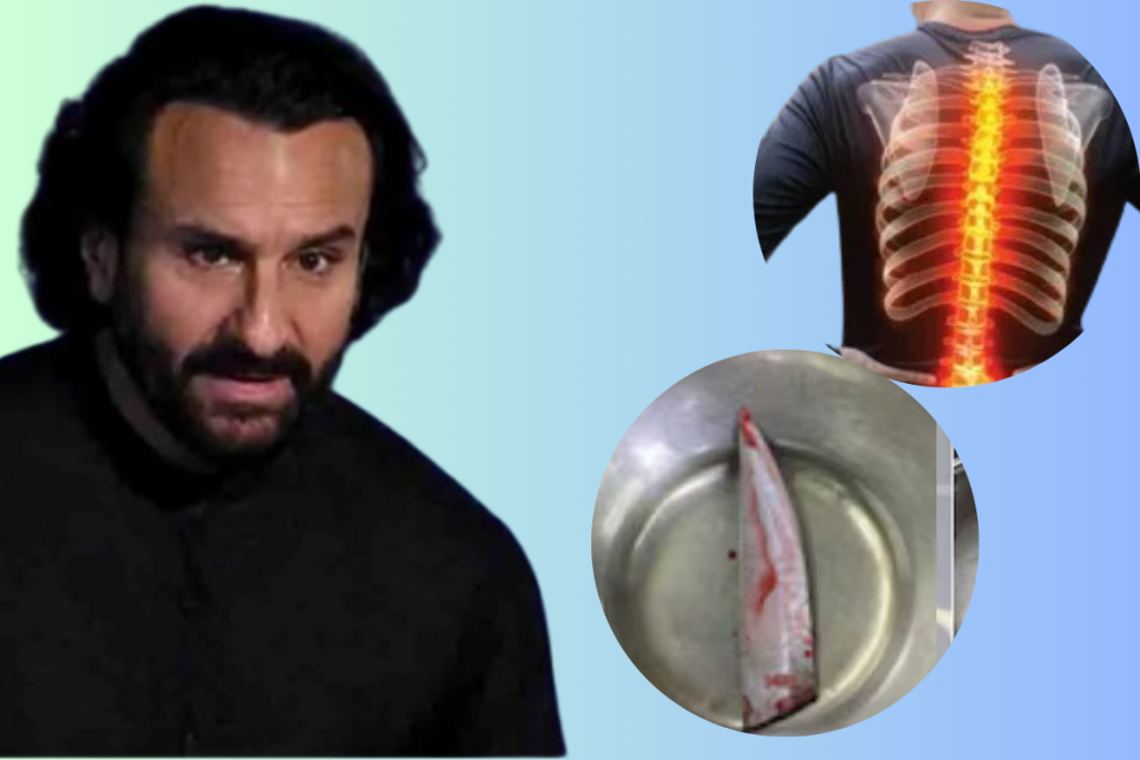 Saif Ali Khan Health Update