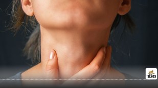 Thyroid Control Naturally with 5 Ayurvedic herbs