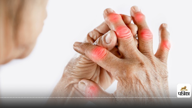 New AI technology will detect arthritis and lupus early