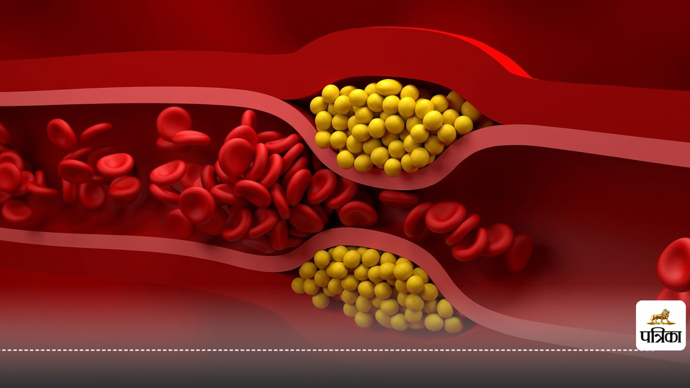 Bad cholesterol को कंट्रोल करने के आसान तरीके