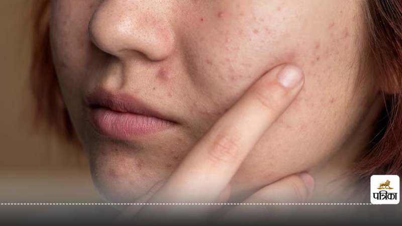 face sign of fatty liver