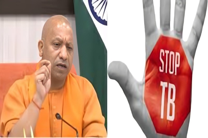 लखनऊ में सबसे ज्यादा 4050 टीबी मरीज चिन्हित, श्रावस्ती में सबसे कम 247 मामले