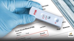 घर पर कैंसर जांच करना कितना सही? जानिए Cancer Test Kit से कैसे करें जांच और क्या
है कीमत - image