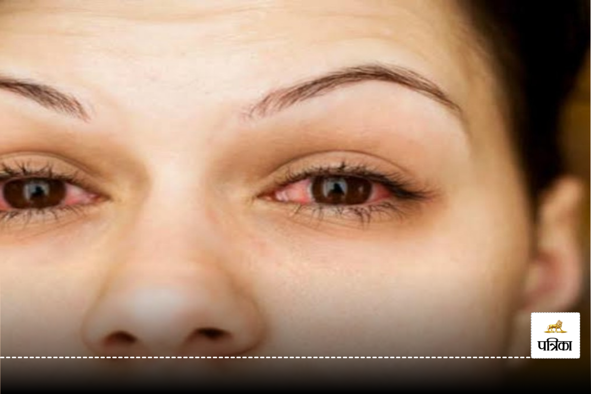 Ayurvedic remedies eye irritation: आंखों की जलन और सूजन के लिए आयुर्वेदिक घरेलू
उपचार, जानें आप