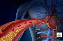 Reduce Cholesterol: लाइफस्टाइल के ये 7 बदलाव दिला सकते हैं बढ़े हुए कोलेस्ट्रॉल
से छुटकारा, जानें आप - image