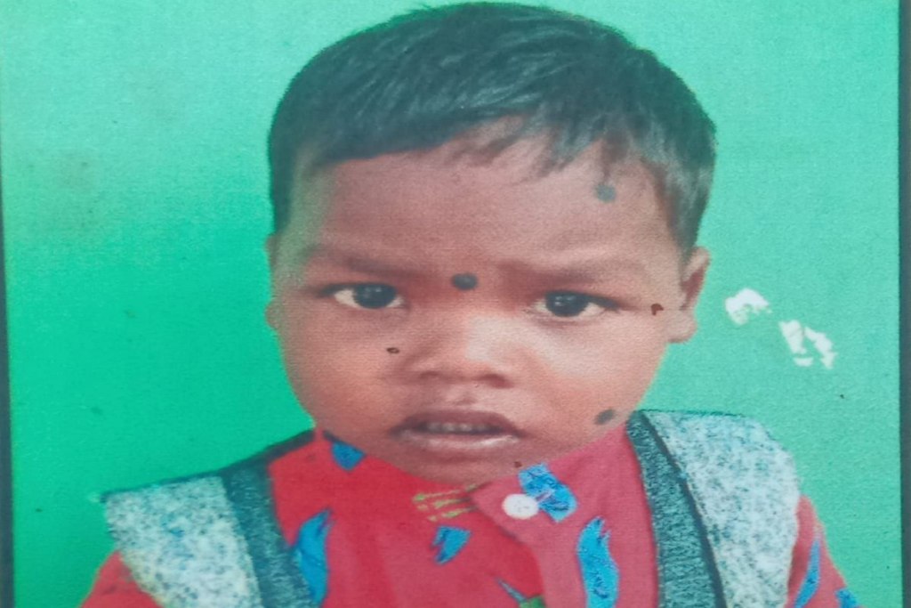 Child died due to dog bite: कुत्ते के काटने 5 वर्षीय मासूम की मौत, घरवालों ने नहीं कराया इलाज, 52 दिन बाद तोड़ा दम